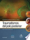 Libro Traumatismos del polo posterior